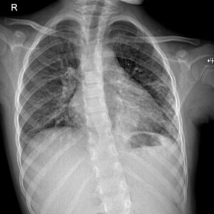 radiología patolótico